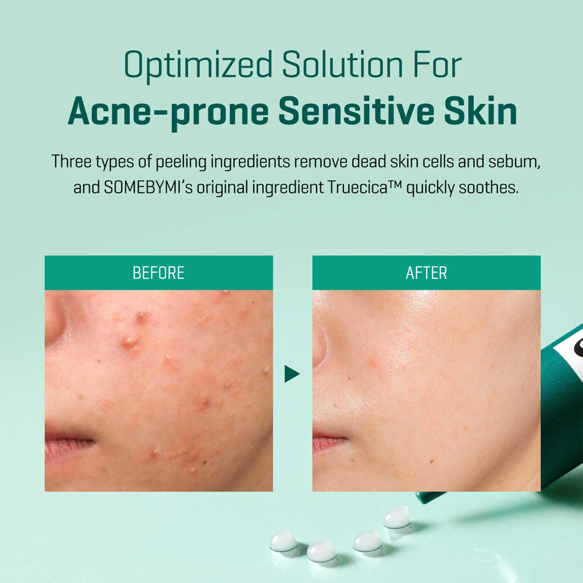 SOME BY MI AHA-BHA-PHA 30 Days Miracle Acne Clear Foam