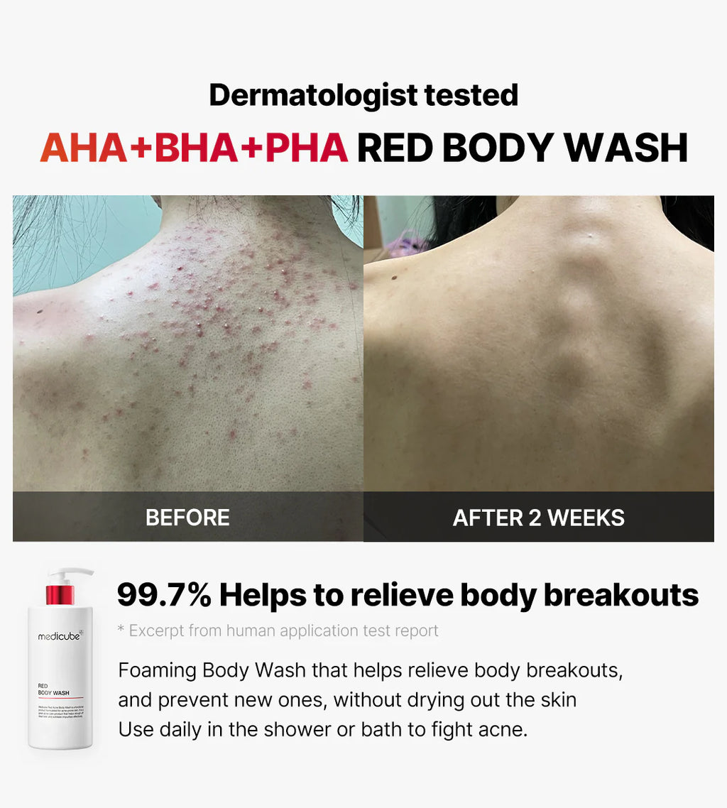 MEDICUBE RED ACNE BODY WASH