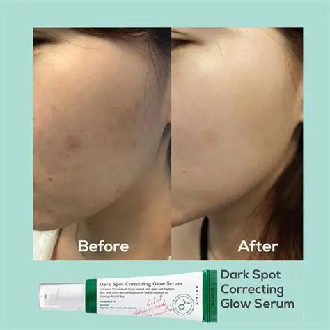 AXIS-Y Dark Spot Correcting Glow Serum 20ml