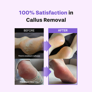 baren Foot Exfoliant Softener At-Home Kit